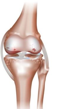 Top 6 Causes Of Stiff Joints After Sitting