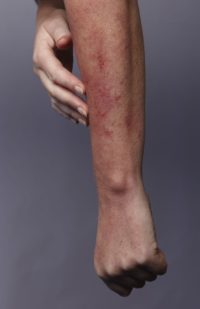 Top 6 Causes Of Stiff Joints After Sitting