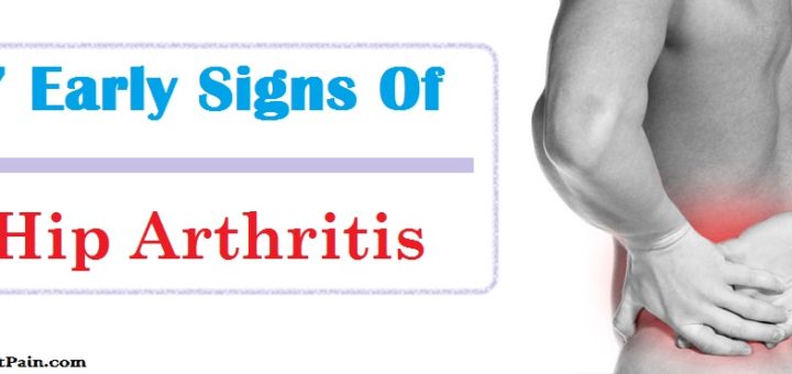 7 Most Common Early Signs Of Hip Arthritis