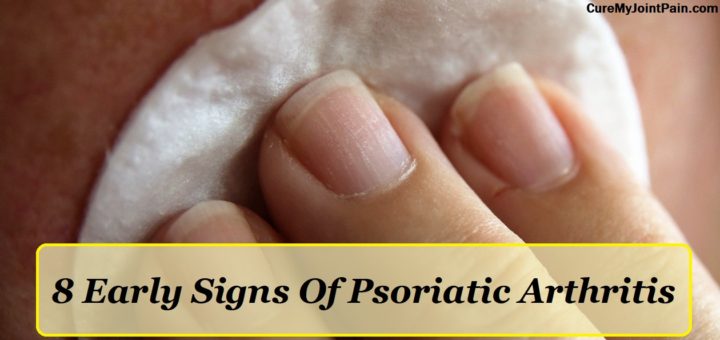 Early Signs Psoriatic Arthritis Archives Cure My Joint Pain
