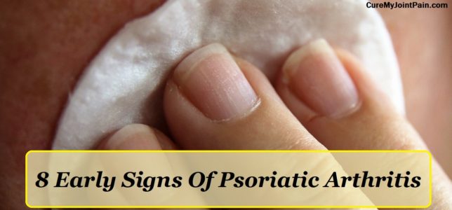 8 Early Signs Of Psoriatic Arthritis