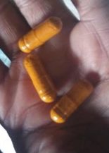 Can Turmeric Cause Diarrhea? 6 Possible Reasons Why