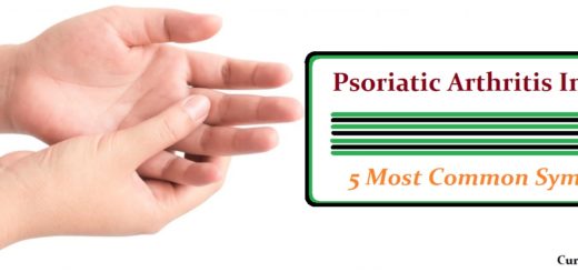 5 Most Common Symptoms Of Psoriatic Arthritis In Hands