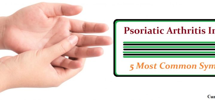 5 Most Common Symptoms Of Psoriatic Arthritis In Hands