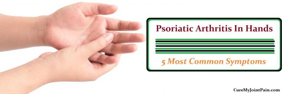 5 Most Common Symptoms Of Psoriatic Arthritis In Hands