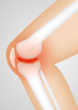 Does Glucosamine Help Arthritis? (4 Real Benefits)