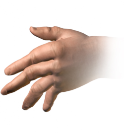 Is MSM Good For Arthritis? The Real Answer