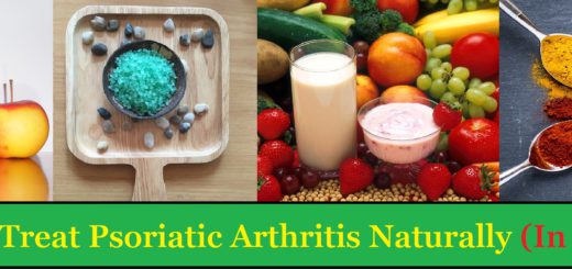 How To Treat Psoriatic Arthritis Naturally (In 9 Steps)